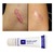 Kem Scar Heal Rejuvasil Hỗ Trợ Chăm Sóc Da Sẹo 10ml Mỹ 2